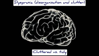 Dyspraxia disorganisation and clutter realistic example [upl. by Salkcin922]