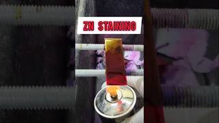 ZN Staining or Ziehl Neelsen staining shorts staining [upl. by Manuela]