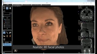 CS 9600 CBCT System – CS Face Scan workflow [upl. by Bottali146]