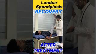 Lumbar Spondylosis Recovery After Treatment yt ytshorts ytviral doctor fitness fit 100 ad [upl. by Norvan]