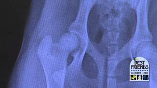 Diagnosis of Hip Dysplasia amp Hip Arthritis [upl. by Havener]