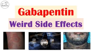 Gabapentin Weird Side Effects Skin Psychological Eyes [upl. by Gnov]