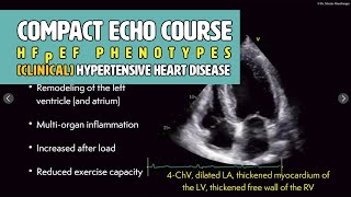 〖Echocardiography〗 Clinical phenotypes of HFpEF  hypertensive heart disease 🫀 [upl. by Mattah]