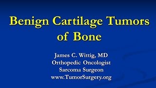 Orthopedic Oncology Course  Benign Cartilage Tumors Osteochondroma Chondroblastoma  Lecture 5 [upl. by Eilatan]