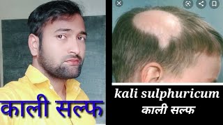 kali sulph।kali sulph 6x uses ।kali sulphuricum 12x uses। Kali sulphuricum ।Kali sulph। Vikas dhp [upl. by Hama241]