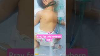 DIAGNOSIS CHDASD baby7 cute baby turtule newbornstyle chd asd viralvideo reels trending [upl. by Sunev66]