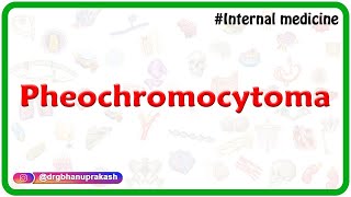 Pheochromocytoma  Internal medicine video lectures for FMGE and NEET  PG [upl. by Naillij]