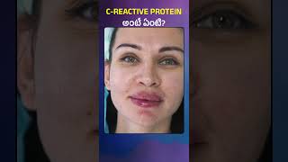 CRP Test  CReactive Protein అంటే ఏంటి  What Is CReactive Protein Why It Is Used for [upl. by Hett]