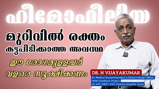 രക്തം കട്ടപിടിക്കാത്ത അവസ്ഥ ഹീമോഫീലിയ രോഗത്തെ പ്രതിരോധിക്കാം  Hemophilia  Dr N Vijayakumar [upl. by Clive]