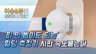 피 안 뽑아도 되는 혈당 측정기 시판 속도붙는다…선의의 경쟁구도 형성  머니투데이방송 뉴스 [upl. by Narod862]