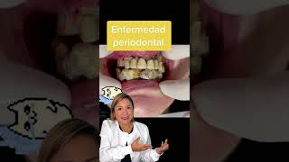 La enfermedad periodontal no solo afecta tus encías también pone en riesgo tus dientes [upl. by Mauchi723]