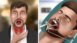 ASMR Animation Remove fish bones stuck in MrBeasts throat [upl. by Rosalinda]