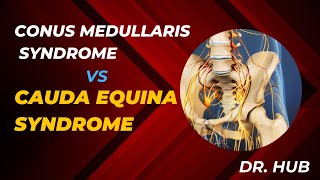 Conus medullaris syndrome vs cauda equina syndrome [upl. by Yseulte]