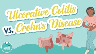 Ulcerative Colitis vs Crohns Disease  Know the Difference  Med Surg Help for Nursing School [upl. by Grobe]