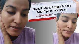 Demelan Cream Benefits amp How To Use Correctly  Pharmacy Cream Demelan [upl. by Garth]