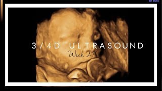 34D ULTRASOUND  27 WEEKS PREGNANT [upl. by Avril]