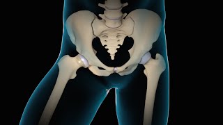 Minimally Invasive Total Hip Replacement  THR  Nucleus Health [upl. by Einnod]