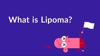 What is Lipoma Fat Lump Under Skin [upl. by Fanchan]