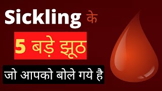 sickling के 5 बड़े झूठ जो आपको बोले गये हैSickle cell Anemia [upl. by Ssalguod355]