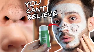 I try VIRAL GREEN MASK STICK amp THIS HAPPENED 😲 Honest Review In Hindi [upl. by Ranson]