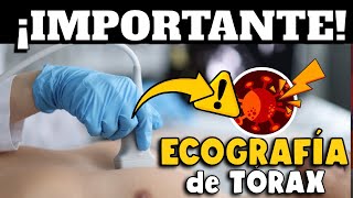 ¿ECOGRAFÍA DE TÓRAX EN COVID19  EXPERTOS DAN RECOMENDACIONES A CONSIDERAR [upl. by Stromberg]