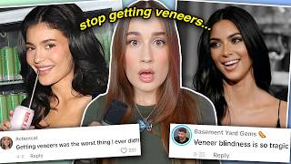 VENEERS ARE RUINING YOUR LIFE scientifically proven [upl. by Blandina855]