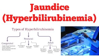 Hyperbilirubinemia  Jaundice  Biochemistry [upl. by Aelam589]