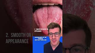 Signs of IRON DEFICIENCY ANAEMIA in the TONGUE  Glossitis explained shorts health anaemia [upl. by Aluap]