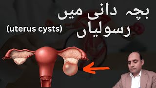 uterus tumor and cyst [upl. by Cadmann]