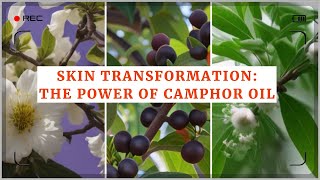 Skin Transformation The Power of Camphor Oil Discover the Wonders of Camphor Oil for Skin [upl. by Allisurd]