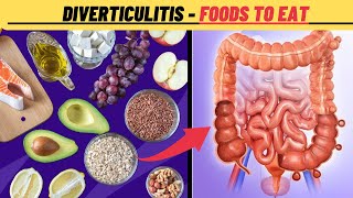 What are the best foods for diverticulitis  Diverticulitis Diet Plan [upl. by Eeneg]