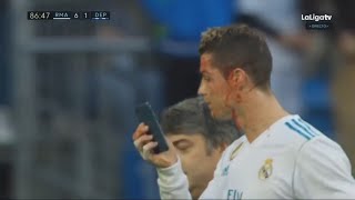 Cristiano Ronaldo Lesión en la cara  Real Madrid vs Deportivo La Coruna 71  La Liga 21012018 [upl. by Ramsey722]