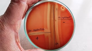 CAMP test for Streptococcus agalactiae  GBS [upl. by Happ]