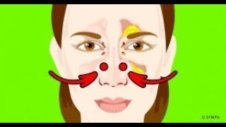 5 Façons efficaces de déboucher ton nez rapidement [upl. by Llorrac752]