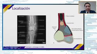 Epidemiología de los tumores musculoesqueléticos [upl. by Trimble105]