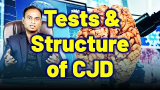 Tests amp Structure Function of Brain in CJD Creutzfeldt Jakob Disease Prion Disease Mad Cow CWD [upl. by Aizek]