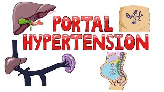 Portal Hypertension  Causes of Portal Hypertension PreIntraPost Hepatic  Symptoms amp Diagnosis [upl. by Nissensohn]