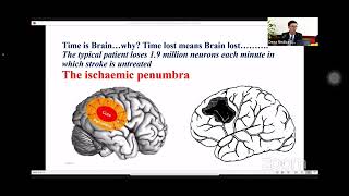 Management of ischemic stroke by Dr Sim Sophana [upl. by Gomer284]