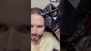 Alopecia androgenética y mesoterapia capilar  Dermarx Clinic Dr Mariano Marx [upl. by Anifesoj809]