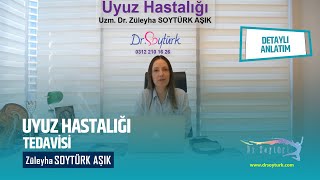 Uyuz Hastalığı [upl. by Ludwigg]