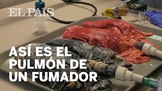 Así se transforma el pulmón de un fumador [upl. by Alcina]