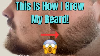 This Is How I Grew My Beard With Minoxidil And a Derma Stamp [upl. by Uba]