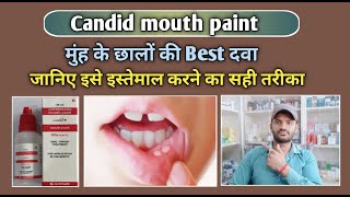 Candid mouth paint use dose benefits and Side effects full review in hindiClotrimazole [upl. by Augusto]