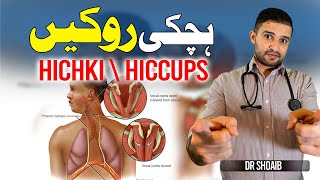 Hichki Kaise Band Kare  Hiccups Treatment in UrduHindi [upl. by Alderson]