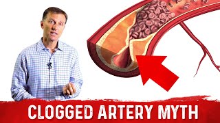 The Clogged Artery Myth – Dr Berg [upl. by Griffie855]