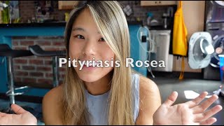 Skin Journey Part 1  My Experience with Pityriasis Rosea [upl. by Tala]