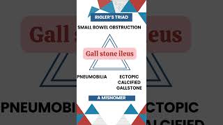 Riglers Triad Key Signs of Gallstone Ileus Explained gallbladderproblems MedicalEducation [upl. by Afihtan76]