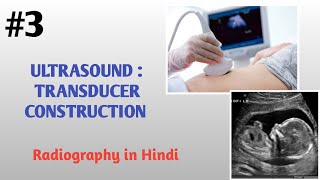 ULTRASOUND  TRANSDUCER CONSTRUCTION [upl. by Narud]