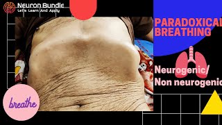 Paradoxical breathing pattern  Diaphragmatic paradox paradoxicalrespiration diaphragmaticpalsy [upl. by Anialahs]