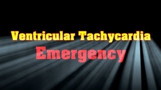 Ventricular Tachycardia Emergency [upl. by Ehsom524]